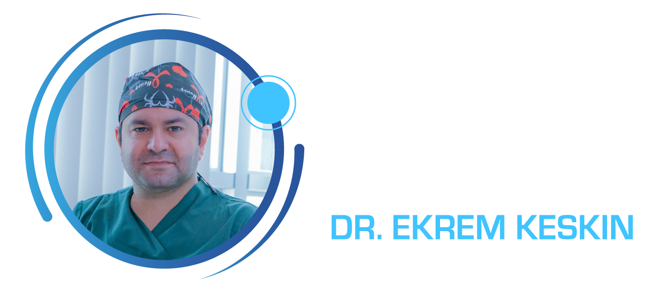 Home Hair Transplant Turkey