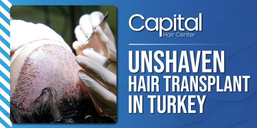 Unshaven Hair Transplant in Turkey