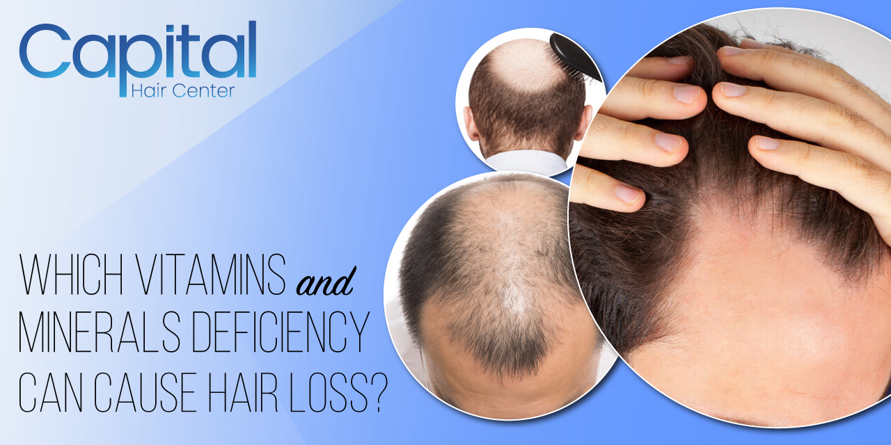 Which Vitamins and Minerals Deficiency Can Cause Hair Loss? - Hair  Transplant Turkey