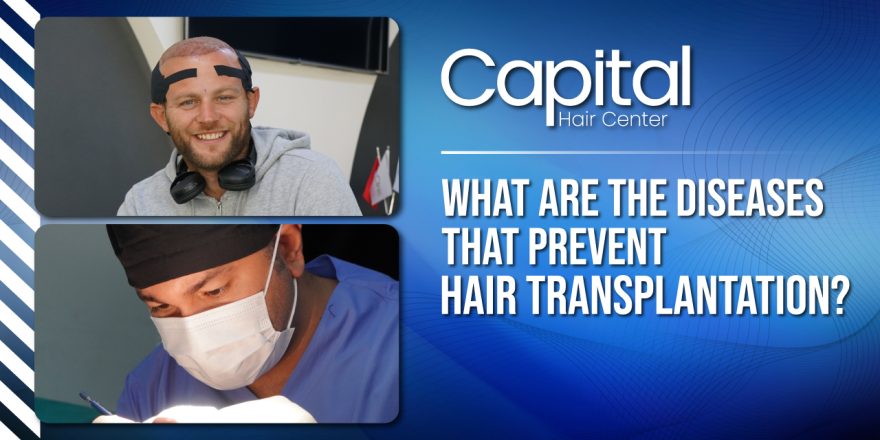 What are the diseases that prevent hair transplantation?
