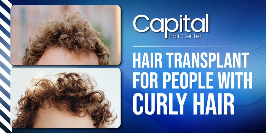 Hair Transplant for People with Curly Hair