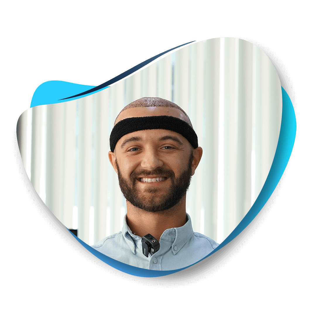 Hair Transplant Without Shaving - Hair Transplant Turkey Hair Transplant Without Shaving - Hair Transplant Turkey