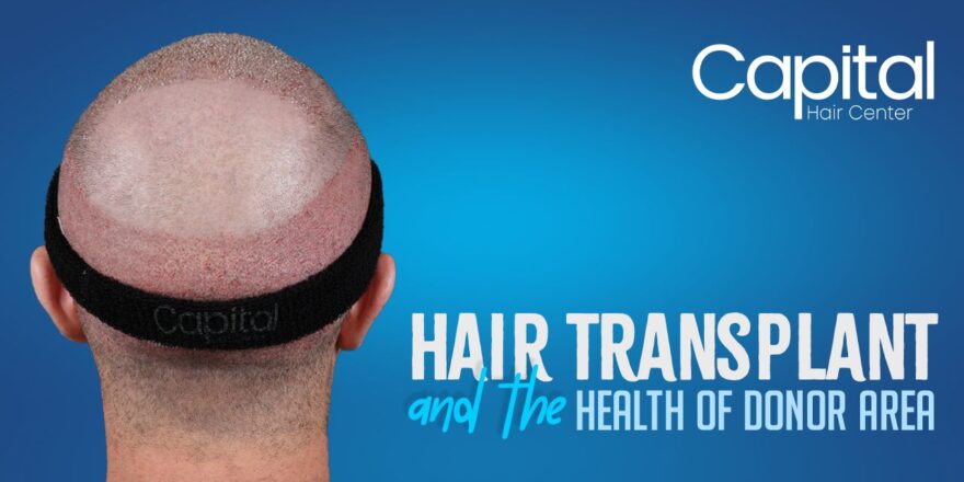 Hair Transplant and the Health of Donor Area