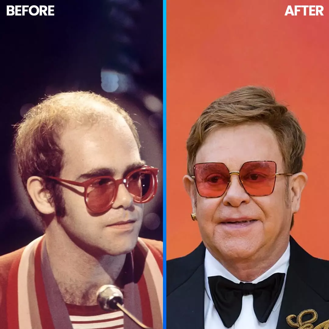 Elton John