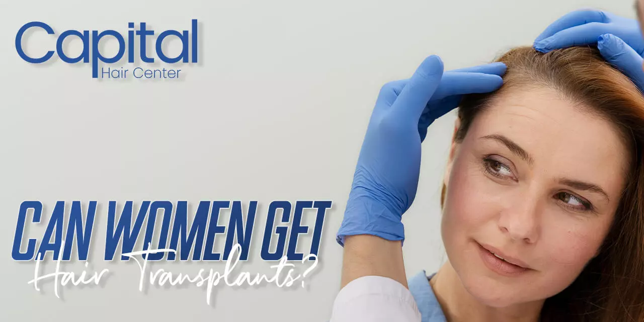 Is Female Hair Transplant Possible?