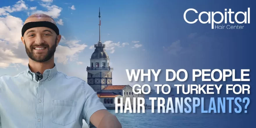 le-go-to-turkey-for-hair-transplants