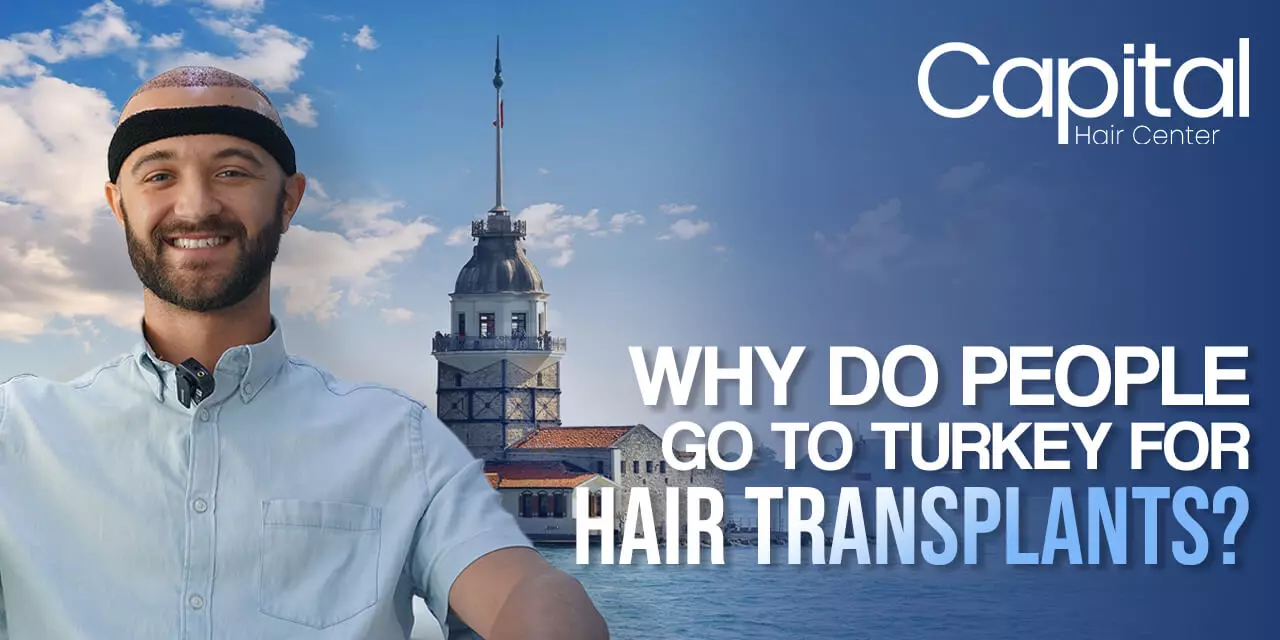 Why Do People Go to Turkey for Hair Transplants?