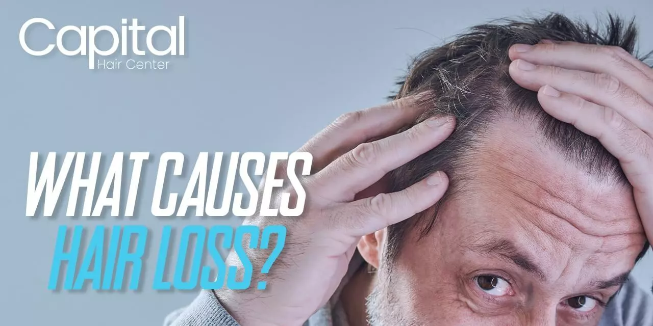 What Causes Hair Loss?