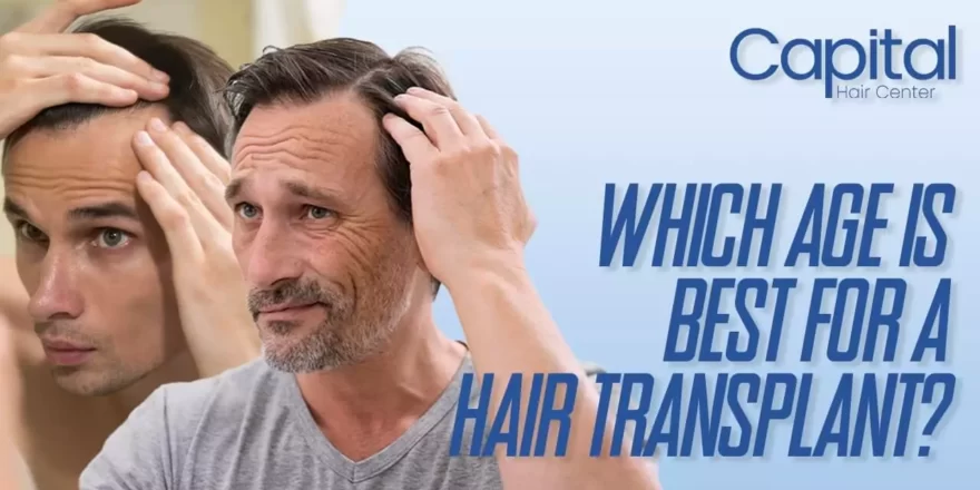 Blog Which Age is the Best for a Hair Transplant