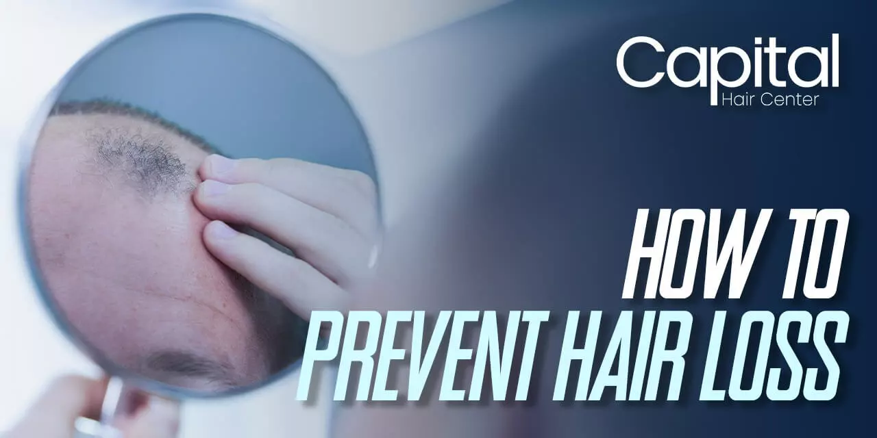 How to Prevent Hair Loss