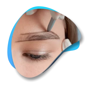 Hair Transplant Cost - Eyebrow transplant